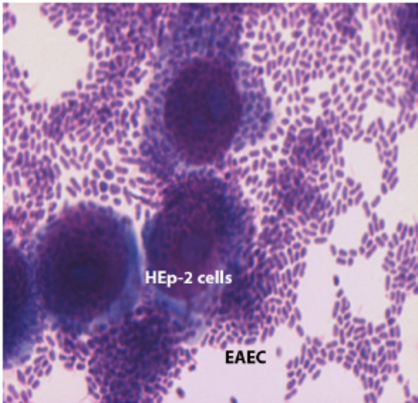 The adherence pattern of enteroaggregative E. coli (EAEC) to HEp-2 cells
